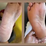 @nusole_footspa
