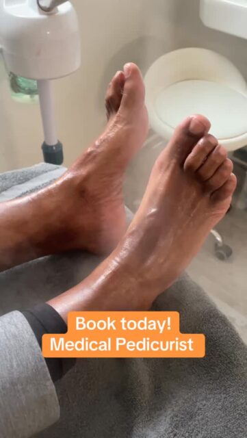 #medicalpedicure❣️ #drypedicure #waterlesspedicures #podiatry #michiganpodiatrist #toenailreconstruction #happyfeet #healthyfeet